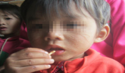 Khởi tố kẻ rạch mặt bé hàng xóm vì thấy giống chồng mình