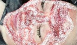 Rùng mình Phi Thanh Vân lấy máu làm đẹp bằng phương pháp ma cà rồng