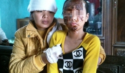 Vợ nạn nhân vụ nổ cassette thấy chồng, con nằm trên vũng máu