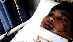 Kêu gọi Bộ di trú Úc phục hồi visa cho du học sinh Việt