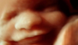 Ngắm khoảnh khắc 3D thai nhi cười trong bụng mẹ đẹp kỳ diệu