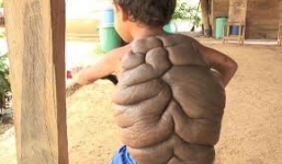 10 vết bớt kỳ lạ chưa từng thấy