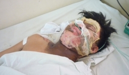 Nóng từ địa phương ngày 23/1: Khánh Hòa - Bỗng dưng… bị chém lúc nửa đêm