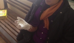 Từ chối 'boa', khách du lịch bị đánh gãy tay