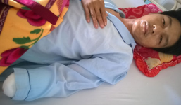 Cự cãi, một thanh niên bị chém đứt lìa cánh tay trái