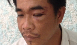 Giả làm khách đến chúc Tết, trộm tiền rồi tẩu thoát