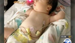 Chuyện lạ: Trẻ sơ sinh không có máu trong người