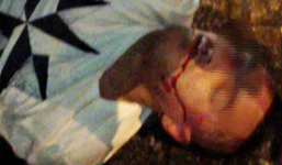 Lấy 2 chai rượu ngoại, Phó chủ tịch xã bị đánh 'vỡ mồm'