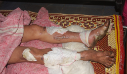 Trang trại bị cháy, công an viên đánh đập, đẩy hàng xóm vào lửa