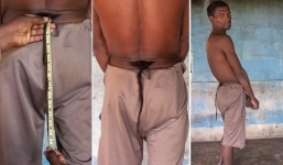 Người đàn ông mọc đuôi được tôn là vị thần