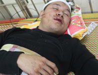 Chủ trọ bị côn đồ đánh trọng thương vì đi... giảng hòa