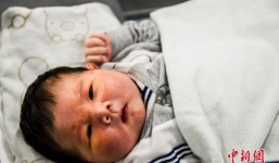 Chùm ảnh: Bé sơ sinh khổng lồ nặng 7,12 kg chào đời