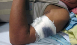 Bản tin 113 – sáng 13/2: Đuổi theo bọn trộm chó, bị chém trọng thương...