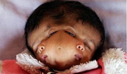 'Dị nhân' nổi tiếng thế giới có khả năng 'quái dị'