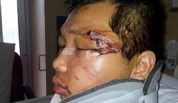 Úc tạo điều kiện cấp visa cho Dương Minh Tuấn