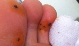 Kinh hoàng lót giầy 'tạo hương thơm' Trung Quốc gây thối chân