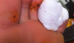 Lót giầy thơm Trung Quốc gây thối chân