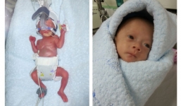 Cận cảnh bé sơ sinh nhỏ xíu bằng lòng bàn tay