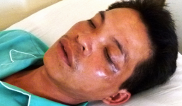 Khi công an dùng nhục hình