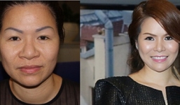 Nữ đại gia U50 chi tiền thẩm mỹ, đăng kí thi Hoa hậu quý bà