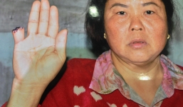 Cắn đứt ngón tay 'đối thủ' vì cạnh tranh bán trà đá?