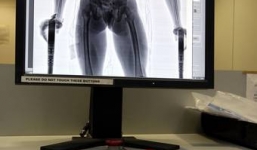 Tên trộm  sợ hãi nuốt viên kim cương hơn 4 tỷ đồng vào bụng