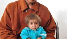 Bé trai 5 tuổi nặng 3kg ở Quảng Ngãi