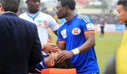 Từ chấn thương khủng khiếp của Bruno: Chuyện mặt cỏ & Nỗi xấu hổ 2 chữ chuyên nghiệp