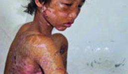 Cuộc đời kỳ lạ của đứa bé một thời bị tra tấn: Thoát khỏi bạo hành, ngỡ mình là “sao”