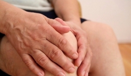 Có thể chẩn đoán sớm bệnh xơ cứng