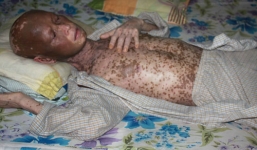 Ăn thịt chó có thể tử vong?