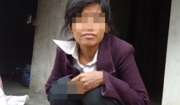 Bí ẩn bệnh lạ khiến người phụ nữ thường xuyên ham muốn “hiến dâng”