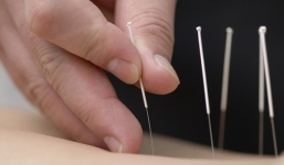 Học sinh 9 tuổi tự đâm 4 cây kim vào bụng