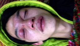 Nhập viện vì bị CSGT 'vô tình” chọc gậy vào mặt