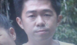 Dược sĩ tạt axit vào người yêu rồi nhảy sông tự vẫn