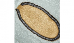 Phát hiện virus khổng lồ 30 nghìn năm tuổi giống virus đậu mùa