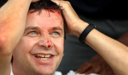 Bị đánh “vỡ đầu”, fan cuồng vẫn thấy sung sướng