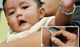 Những “cái quên” chết người của bác sĩ