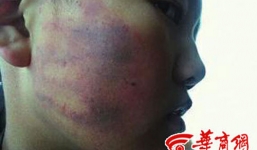 Cô giáo bắt học sinh ăn chuối hỏng trong thùng rác