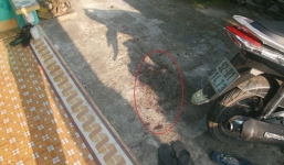 Nổ súng bắn xuyên gò má người yêu rồi chở đi cấp cứu