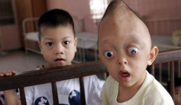 Trẻ em da cam Việt Nam qua ống kính nhiếp ảnh gia người Mỹ