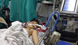 Cháu bé bị bố đánh bằng điếu cày đã tử vong