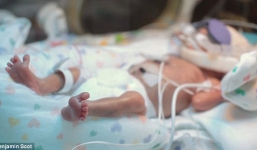 Clip rơi nước mắt của người cha tặng con trai sinh non 15 tuần