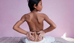 Cậu bé 12 tuổi có đuôi được tôn sùng như thánh sống