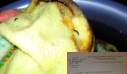 Đã có kết quả xét nghiệm vụ khăn tắm 'nở' ra ấu trùng