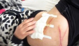 Lộ danh tính kẻ bệnh hoạn rạch mông nữ sinh ở Khánh Hòa?