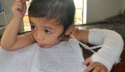 Bé 2 tuổi đi học, gãy tay không rõ lí do