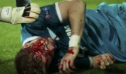 Cầu thủ Zenit bất tỉnh trên sân với khuôn mặt đẫm máu