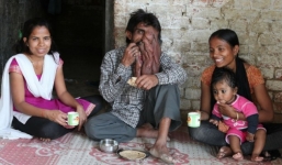 Cận cảnh khuôn mặt biến dạng vì khối u nặng 4kg