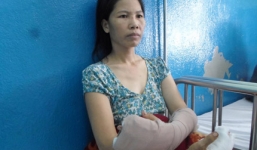 Hoang mang tin đồn “chặt tay cướp tài sản” giữa phố ở Sài thành